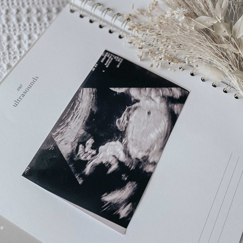 
                  
                    My Baby Book - Baby Memory Book - Misty
                  
                